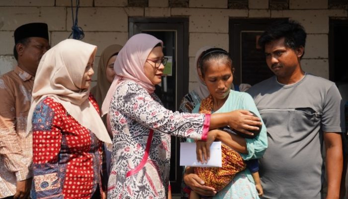 Bupati Nina Agustina Sigap Tangani Pengobatan Muhammad Tahta Sipenderita Pembesaran Perut
