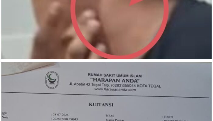 Dugaan Kuat Andi Haryanto Pukul Wartawan MeteorNews Berakhir Damai